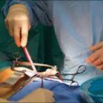 Couple Alleges Wife’s Kidney Removed Without Consent During Hospital C-Section Birth Couple Alleges Wife’s Kidney Removed Without Consent During Hospital C-Section Birth